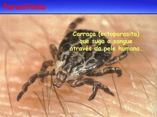 Parasitismo
Carraça (ectoparasita)
que suga o sangue
através da pele humana.

 
