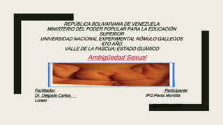 REPÚBLICA BOLIVARIANA DE VENEZUELA
MINISTERIO DEL PODER POPULAR PARA LA EDUCACIÓN
SUPERIOR
UNIVERSIDAD NACIONAL EXPERIMENTAL RÓMULO GALLEGOS
6TO AÑO
VALLE DE LA PASCUA; ESTADO GUÁRICO
Ambigüedad Sexual
Facilitador: Participante:
Dr. Delgado Carlos. IPG:Paola Montilla
Loreto
C.I: 27.841.518
 