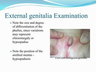 Ambiguous Genitalia In Newborn