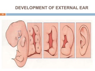 DEVELOPMENT OF EXTERNAL EAR
20
 