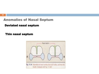 Anomalies of Nasal Septum
Deviated nasal septum
Thin nasal septum
43
 