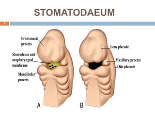 STOMATODAEUM
6
 