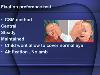 Fixation Preference Testing Amblyopia | PPT
