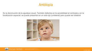 12/09/2022
Ambliopía
Es la disminución de la agudeza visual .También defectos en la sensibilidad al contraste y en la
localización espacial, se puede presentar en un solo ojo (unilateral) pero puede ser bilateral
 