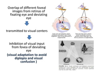 Overlap of different foveal
images from retinas of
fixating eye and deviating
eye
transmitted to visual centers
Inhibition of visual input
from fovea of deviating
eye
(visual adaptation to avoid
diplopia and visual
confusion )
 