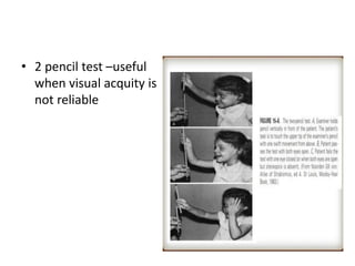 • 2 pencil test –useful
when visual acquity is
not reliable
 