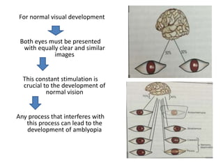 For normal visual development
Both eyes must be presented
with equally clear and similar
images
This constant stimulation is
crucial to the development of
normal vision
Any process that interferes with
this process can lead to the
development of amblyopia
 
