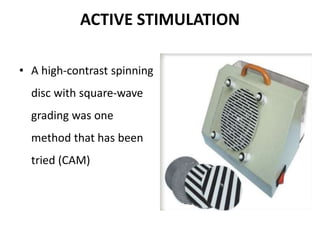 ACTIVE STIMULATION
• A high-contrast spinning
disc with square-wave
grading was one
method that has been
tried (CAM)
 