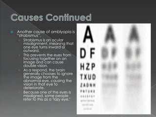 Amblyopia | PPTX
