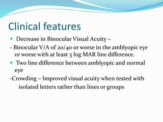 Amblyopia | PPTX
