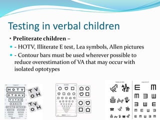 Amblyopia | PPTX