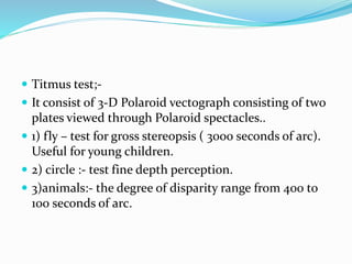 Timus Test Amblyopia | PPTX