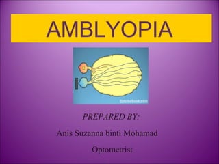AMBLYOPIA
PREPARED BY:
Anis Suzanna binti Mohamad
Optometrist
 