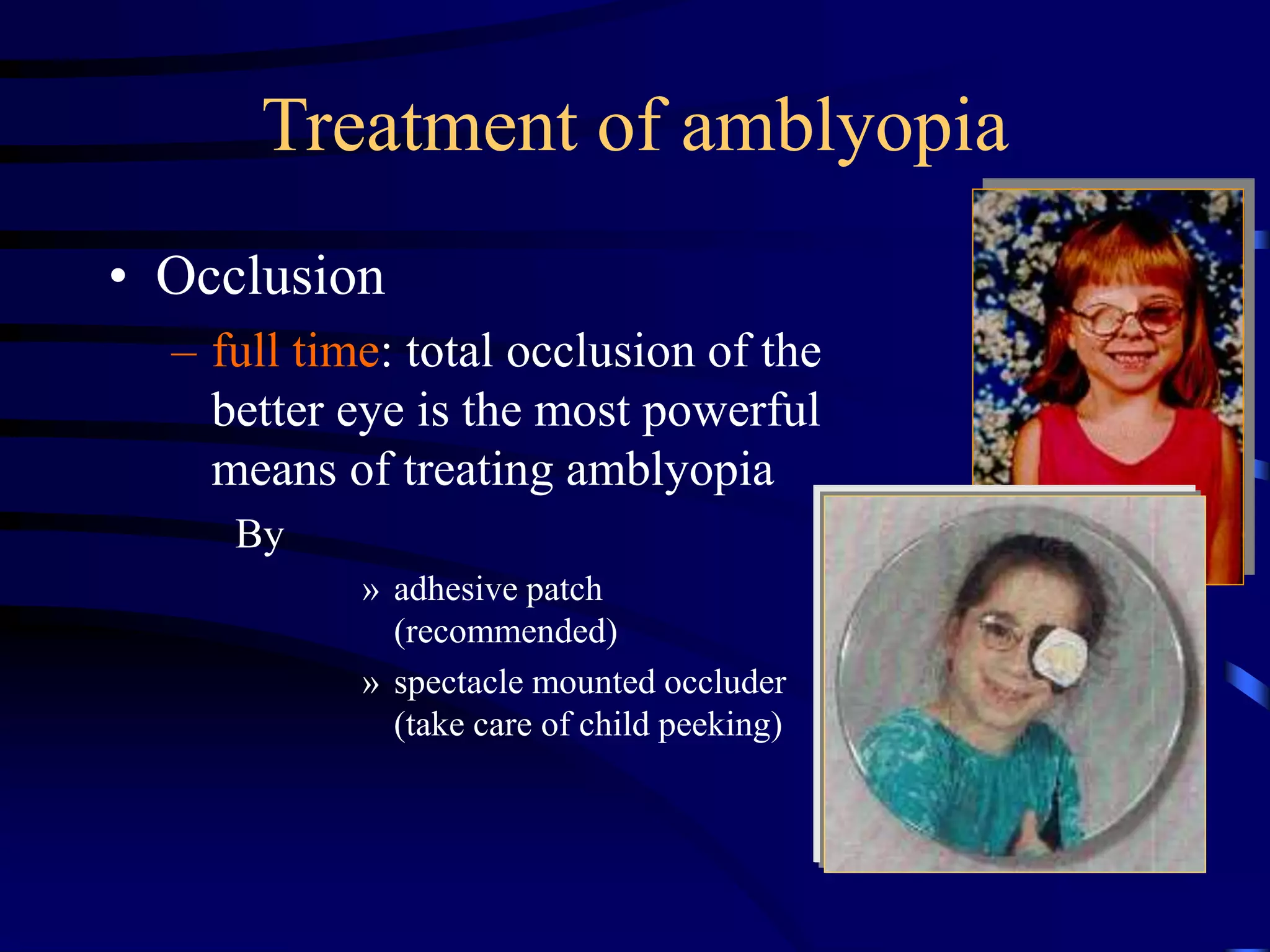 Treatment of amblyopia
• Occlusion
– full time: total occlusion of the
better eye is the most powerful
means of treating amblyopia
By
» adhesive patch
(recommended)
» spectacle mounted occluder
(take care of child peeking)
 