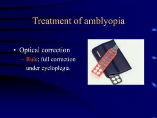 Treatment of amblyopia
• Optical correction
– Rule: full correction
under cycloplegia
 