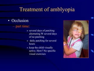 Treatment of amblyopia
• Occlusion
– part time:
» several days of patching
alternating W several days
of no patching
» daily patching for several
hours
» keep the child visually
active. How? No specific
visual exercises
 