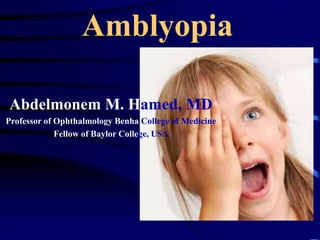 Amblyopia
Abdelmonem M. Hamed, MD
Professor of Ophthalmology Benha College of Medicine
Fellow of Baylor College, USA
 