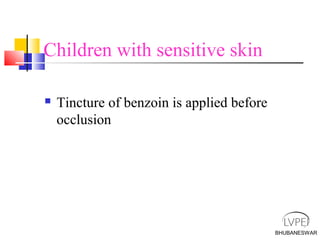 BHUBANESWAR
Children with sensitive skin
 Tincture of benzoin is applied before
occlusion
 