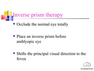 BHUBANESWAR
Inverse prism therapy
 Occlude the normal eye totally
 Place an inverse prism before
amblyopic eye
 Shifts the principal visual direction to the
fovea
 