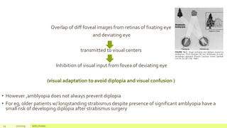 Overlap of diff foveal images from retinas of fixating eye
and deviating eye
transmitted to visual centers
Inhibition of visual input from fovea of deviating eye
(visual adaptation to avoid diplopia and visual confusion )
• However ,amblyopia does not always prevent diplopia
• For eg, older patients w/ longstanding strabismus despite presence of significant amblyopia have a
small risk of developing diplopia after strabismus surgery
24 2/2/2019 Add a footer
 