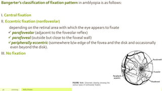 Bangerter’s classification of fixation pattern in amblyopia is as follows:
I. Central fixation
II. Eccentric fixation (nonfoveolar)
depending on the retinal area with which the eye appears to fixate
 parafoveolar (adjacent to the foveolar reflex)
 parafoveal (outside but close to the foveal wall)
peripherally eccentric (somewhere b/w edge of the fovea and the disk and occasionally
even beyond the disk).
III. No fixation
30 2/2/2019 Add a footer
 