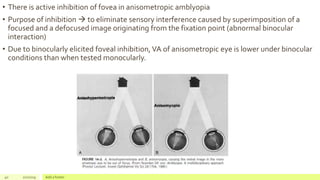 • There is active inhibition of fovea in anisometropic amblyopia
• Purpose of inhibition  to eliminate sensory interference caused by superimposition of a
focused and a defocused image originating from the fixation point (abnormal binocular
interaction)
• Due to binocularly elicited foveal inhibition, VA of anisometropic eye is lower under binocular
conditions than when tested monocularly.
40 2/2/2019 Add a footer
 