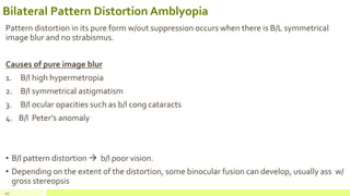 Bilateral Pattern Distortion Amblyopia
Pattern distortion in its pure form w/out suppression occurs when there is B/L symmetrical
image blur and no strabismus.
Causes of pure image blur
1. B/l high hypermetropia
2. B/l symmetrical astigmatism
3. B/l ocular opacities such as b/l cong cataracts
4. B/l Peter’s anomaly
• B/l pattern distortion  b/l poor vision.
• Depending on the extent of the distortion, some binocular fusion can develop, usually ass w/
gross stereopsis
45
 