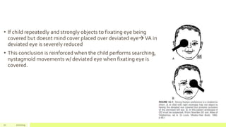 • If child repeatedly and strongly objects to fixating eye being
covered but doesnt mind cover placed over deviated eyeVA in
deviated eye is severely reduced
• This conclusion is reinforced when the child performs searching,
nystagmoid movements w/ deviated eye when fixating eye is
covered.
71 2/2/2019
 