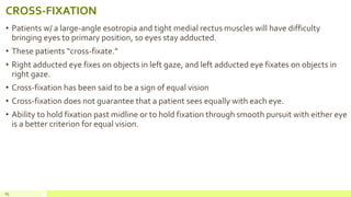 CROSS-FIXATION
• Patients w/ a large-angle esotropia and tight medial rectus muscles will have difficulty
bringing eyes to primary position, so eyes stay adducted.
• These patients “cross-fixate.”
• Right adducted eye fixes on objects in left gaze, and left adducted eye fixates on objects in
right gaze.
• Cross-fixation has been said to be a sign of equal vision
• Cross-fixation does not guarantee that a patient sees equally with each eye.
• Ability to hold fixation past midline or to hold fixation through smooth pursuit with either eye
is a better criterion for equal vision.
85
 