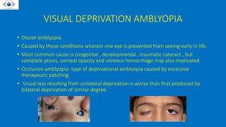 VISUAL DEPRIVATION AMBLYOPIA
• Disuse amblyopia.
• Caused by those conditions wherein one eye is prevented from seeing early in life.
• Most common cause is congenital , developmental , traumatic cataract , but
complete ptosis, corneal opacity and vitreous hemorrhage may also implicated.
• Occlusion amblyopia- type of deprivational amblyopia caused by excessive
therapeutic patching.
• Visual loss resulting from unilateral deprivation is worse than that produced by
bilateral deprivation of similar degree.
 