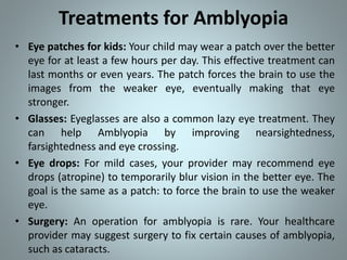 Amblyopia | PPTX