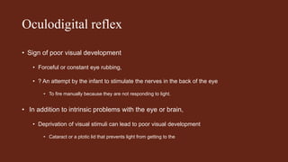 Oculodigital reflex
• Sign of poor visual development
• Forceful or constant eye rubbing,
• ? An attempt by the infant to stimulate the nerves in the back of the eye
• To fire manually because they are not responding to light.
• In addition to intrinsic problems with the eye or brain,
• Deprivation of visual stimuli can lead to poor visual development
• Cataract or a ptotic lid that prevents light from getting to the
 