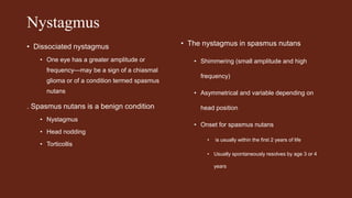 Nystagmus
• Dissociated nystagmus
• One eye has a greater amplitude or
frequency—may be a sign of a chiasmal
glioma or of a condition termed spasmus
nutans
. Spasmus nutans is a benign condition
• Nystagmus
• Head nodding
• Torticollis
• The nystagmus in spasmus nutans
• Shimmering (small amplitude and high
frequency)
• Asymmetrical and variable depending on
head position
• Onset for spasmus nutans
• is usually within the first 2 years of life
• Usually spontaneously resolves by age 3 or 4
years
 