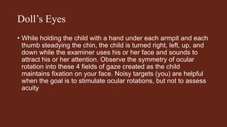 Doll’s Eyes
• While holding the child with a hand under each armpit and each
thumb steadying the chin, the child is turned right, left, up, and
down while the examiner uses his or her face and sounds to
attract his or her attention. Observe the symmetry of ocular
rotation into these 4 fields of gaze created as the child
maintains fixation on your face. Noisy targets (you) are helpful
when the goal is to stimulate ocular rotations, but not to assess
acuity
 