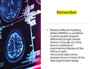 Amblyopia vision therapy for optometry students | PPTX