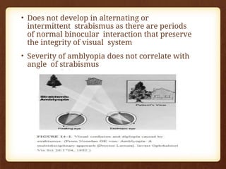 • Does not develop in alternating or
intermittent strabismus as there are periods
of normal binocular interaction that preserve
the integrity of visual system
• Severity of amblyopia does not correlate with
angle of strabismus
 