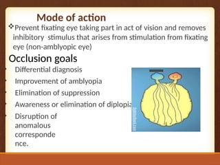 Mode of action
Prevent fixating eye taking part in act of vision and removes
inhibitory stimulus that arises from stimulation from fixating
eye (non-amblyopic eye)
Occlusion goals
• Differential diagnosis
• Improvement of amblyopia
• Elimination of suppression
• Awareness or elimination of diplopia
• Disruption of
anomalous
corresponde
nce.
 