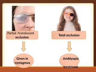Partial /translucent
occlusion
Total occlusion
Given in
nystagmus
Amblyopia
treatment
 
