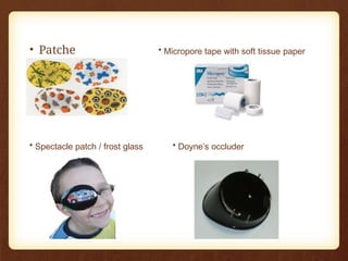 • Patche
s
• Micropore tape with soft tissue paper
• Spectacle patch / frost glass • Doyne’s occluder
 