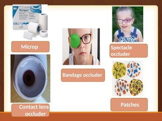 Contact lens
occluder
Bandage occluder
Patches
Microp
ore
Spectacle
occluder
 
