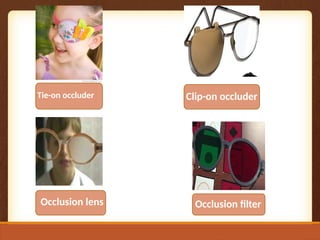 Tie-on occluder Clip-on occluder
Occlusion lens Occlusion filter
 