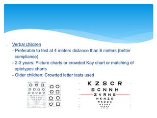 AMBLYOPIA.pptx lazy eye strabismus , chiuldhood developmental | PPTX