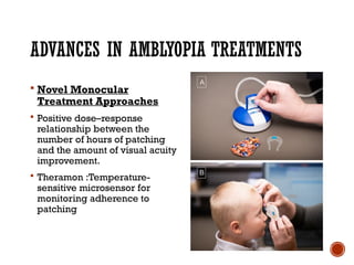 Amblyopia: Definition, classification and Management | PPTX