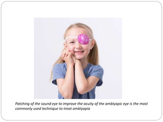 the charactersitics of AMBLYOPIA abi.pptx