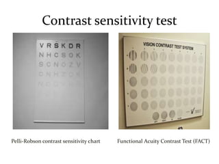 Contrast Sensitivity Chart.pdf AMBLYOPIA, CLASSIFICATION & MANAGEMENT - Modified.pptx