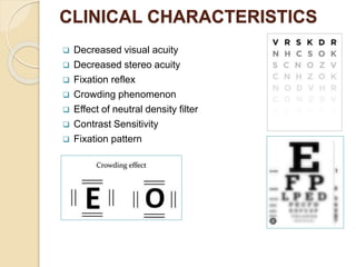 AMBLYOPIA (LAZY EYE).pptx lasy eye human disorder | PPTX