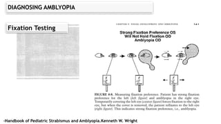 Fixation Preference Testing amblyopia ppt.edit.pptx