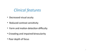 Comprehensive Overview of Amblyopia: Definition, Classification, and ...