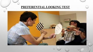 Preferential Test Amblyopia and it's Management | PPTX