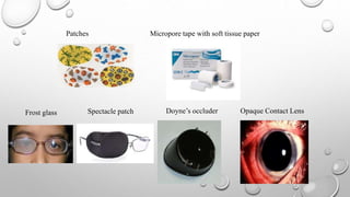 Tissue Spectacle Amblyopia and it's Management | PPTX